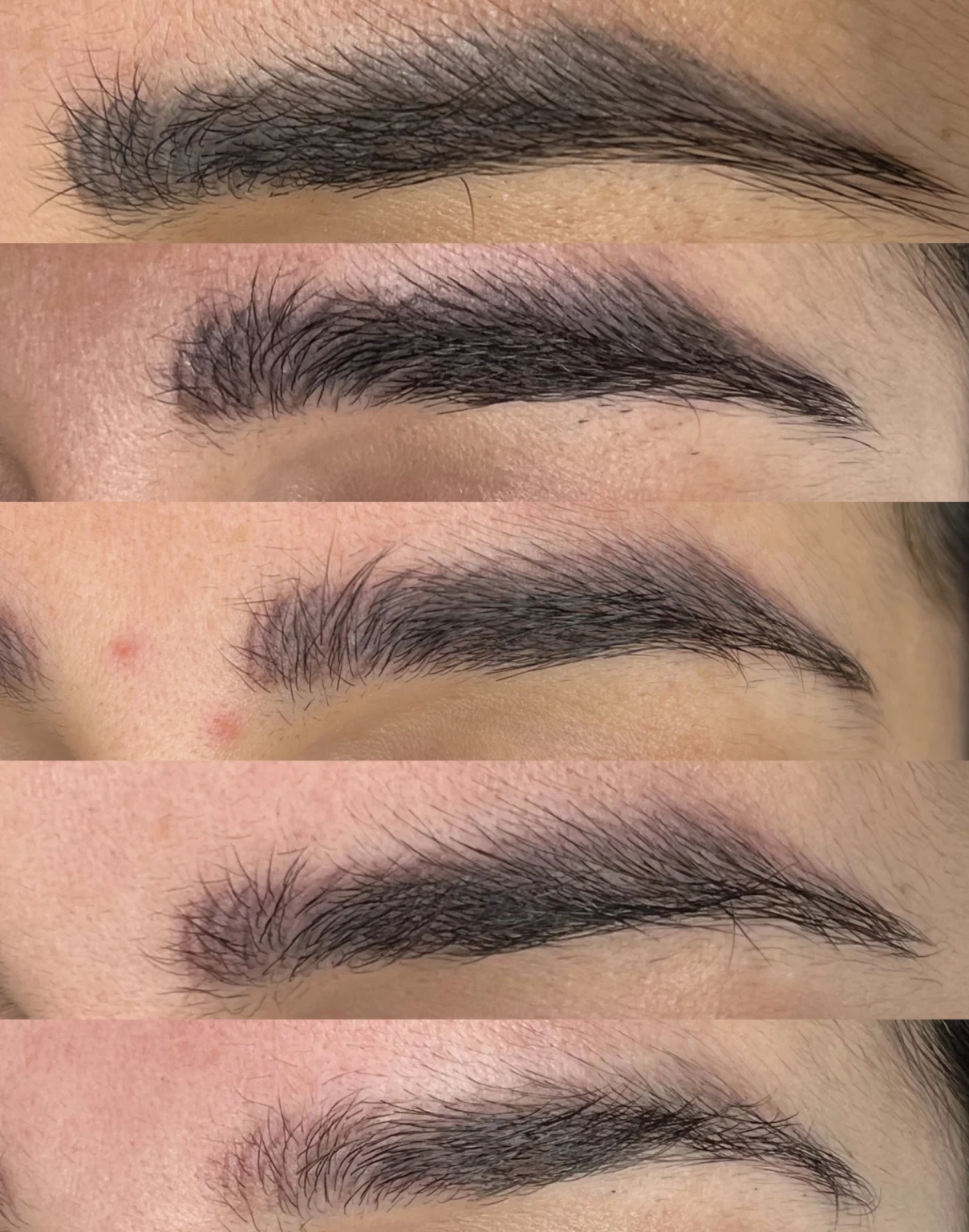 Permanent Make Up & Tattoo Removal