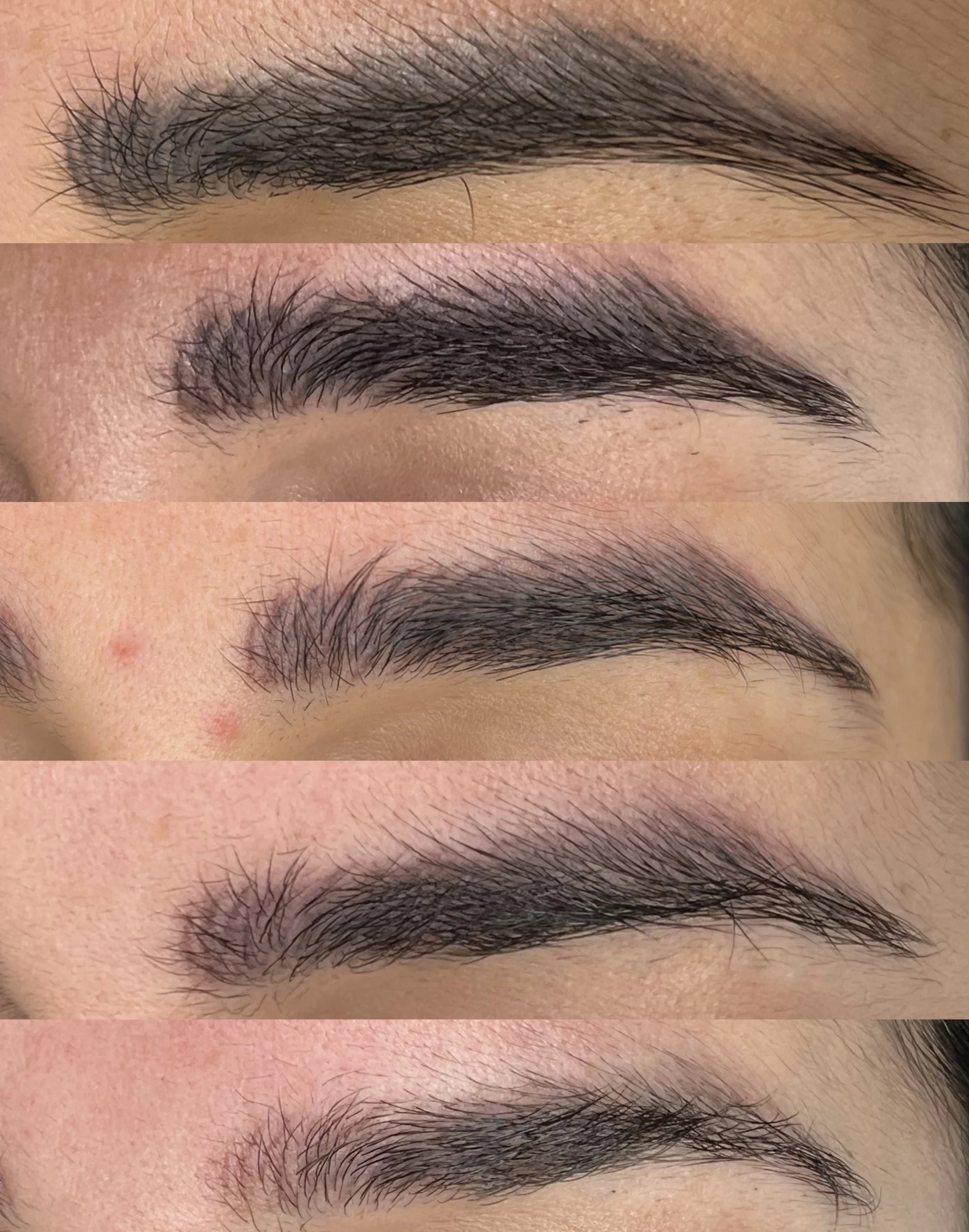 Permanent Make Up & Tattoo Removal
